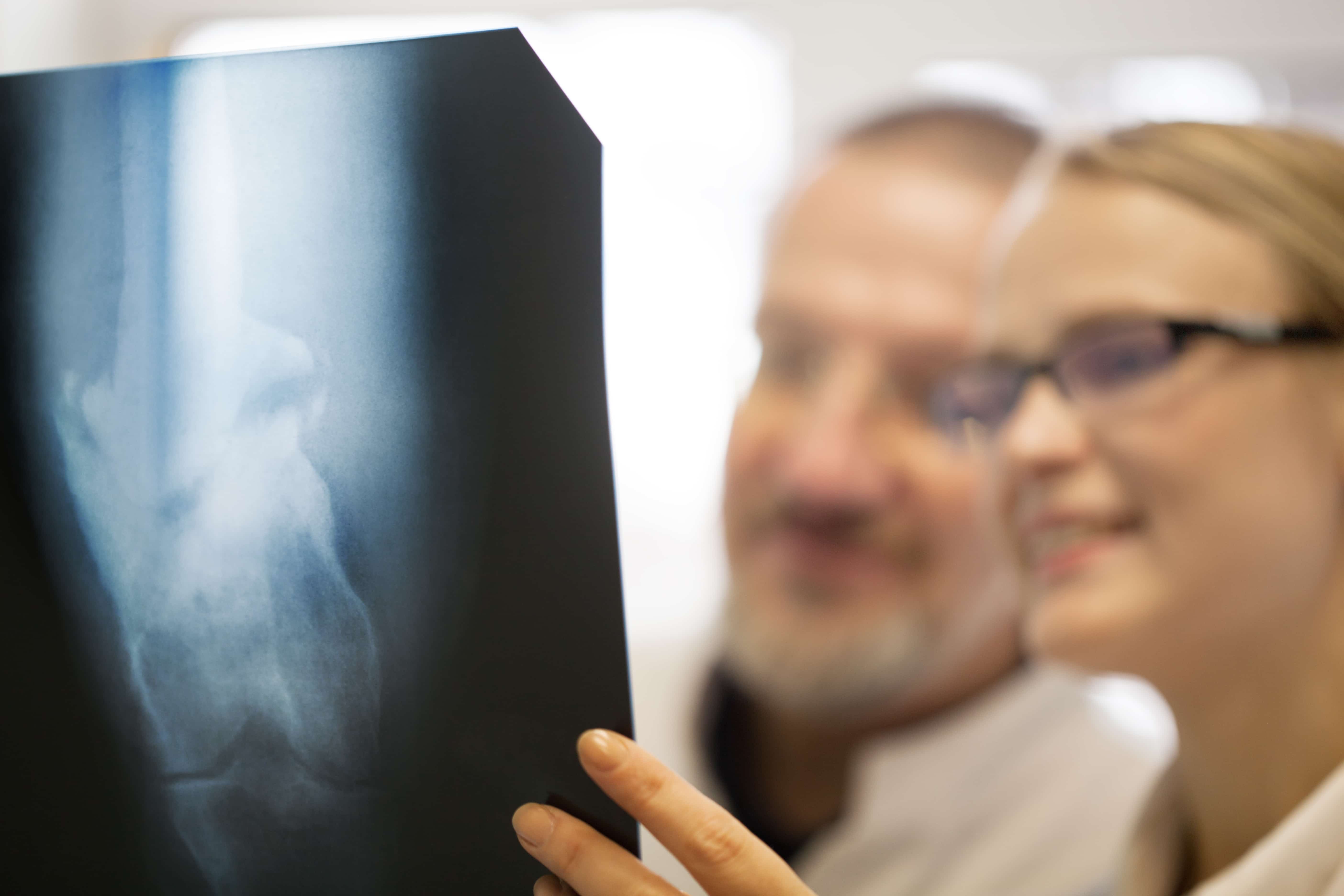 Portable X-Ray